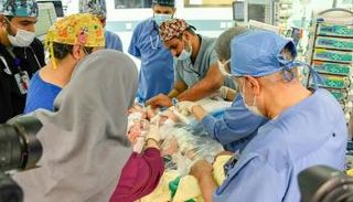 عملية فصل التوأم العراقي "عمر وعلي" بالسعودية