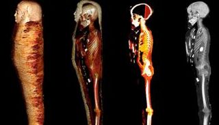 مومياء الصبي تحت الأشعة المقطعية