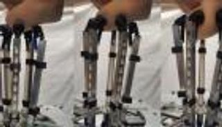 تطور رائد.. روبوت يسبق الأطباء في اكتشاف سرطان خطير