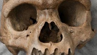 جمجمة بشرية - تعبيرية