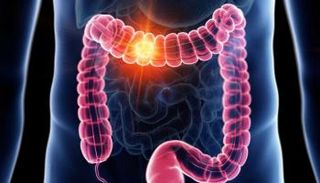 الأمعاء البشرية