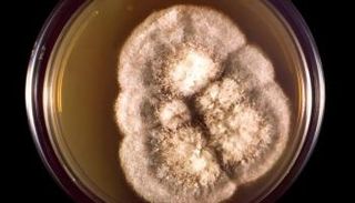 صورة مجهرية لفطر Coccidioides immitis، مصدر الصورة: ويكيبيديا.