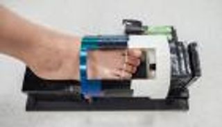 "جل" يشفي جروح السكري.. يمنع الوصول إلى "بتر الأطراف"