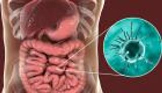 هل عدوى الأميبا خطيرة؟ وما أعراضها وأسبابها وطرق علاجها؟