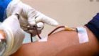 زيادة كثافة الدم في الجسم.. الوقاية والمخاطر