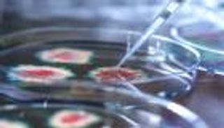 فيروس «لم يسبق له مثيل» يصيب شابا في بيرو