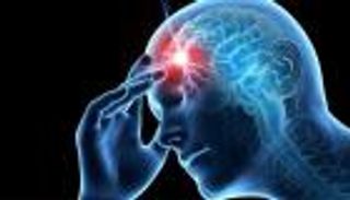 "الصداع النصفي"...هذه الفئات في دائرة الخطر