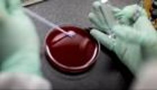 اختبار دم يكتشف «السلوك الانتحاري».. دراسة تفجر مفاجأة