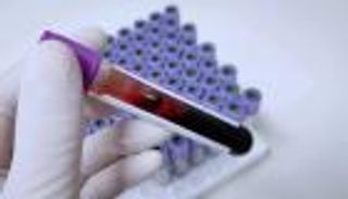 سر "الخزعة السائلة".. هل يصبح فحص الدم كافيا لرصد السرطان؟