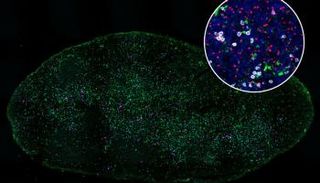 الخلايا التغصنية (الخضراء) تفشل في تحفيز الخلايا التائية (البيضاء)