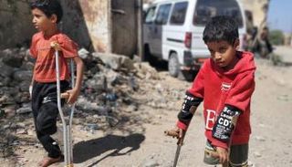 بدر ومحمد اللذان بترت أقدامهما بسبب قذيفة حوثية