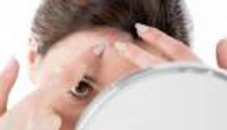 البثور الهرمونية على جسم المرأة.. حلول نهائية