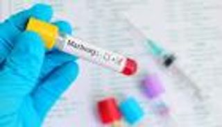 "الصحة المصرية" تكشف حقيقة رصد حالات مصابة بـ"ماربورغ"