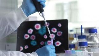 وكورونا وماربوغ يواصلان الانتشار في العالم