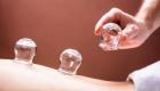 رمضان 2023.. حكم الحجامة ونقل الدم أثناء الصوم