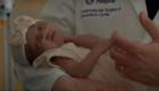 "إنجاز طبي مثير".. نجاح جراحة لدماغ جنين في رحم أمه