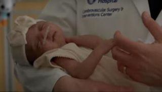 نجاح عملية جراحية لدماغ رضيع
