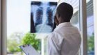 ثالث مرض مسبب للوفاة حول العالم.. تحذير وأرقام صادمة