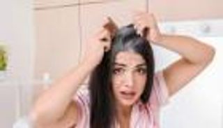 نقص الميلانين في الشعر.. 6 أسباب تؤدي إليه وطرق بسيطة للعلاج