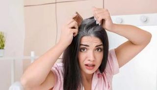 نقص الميلانين في الشعر