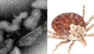 الإعلان عن أول وفاة في العالم بفيروس "أوز"