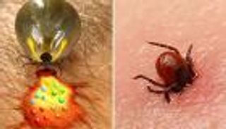 ما هو فيروس "أوز" القاتل؟ (فيديو)