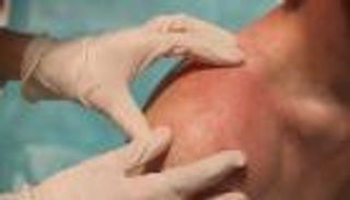 مستحضرات ما بعد التعرض للشمس.. هل تغني عن الكريمات الواقية؟