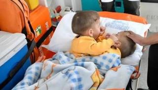 التوأم السيامي السوري بسام وإحسان