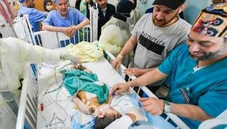 التوأم السيامي 