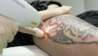 الفن الأكثر إثارة للجدل.. تاريخ الوشم من الإجرام إلى مدارج الموضة