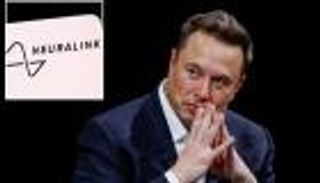 تمويل ضخم لمشروع "ماسك" المثير.. قريبا شرائح في أدمغة البشر