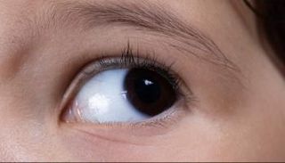 عين بشرية - أرشيفية