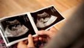 "حملته 40 عاما".. جنين متحجّر يرسل مسنة إلى المستشفى