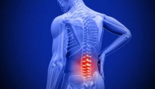 الانزلاق الفقري أحد الأسباب الشائعة لآلام الظهر