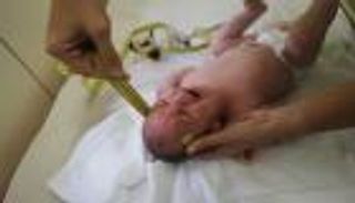 استئصال ورم بارز ينقذ حياة طفلة حديثة الولادة بالسعودية