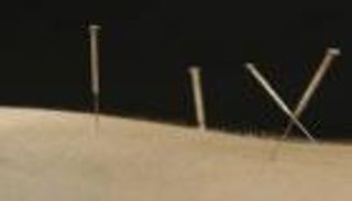 "الصحة العالمية" تكشف موقفها من تقنية الوخز بالإبر