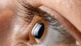 انقطاع الطمث.. كيف يؤثر على شكل عين المرأة؟