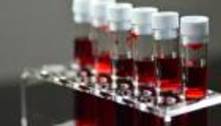 اكتشاف التسلسل الجيني لفصيلة دم نادرة للغاية