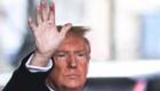 بقع حمراء في كفه.. هل ترامب بصحة جيدة؟