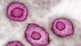 مفاجأة.. فيروس يصيب «معظم الناس» يسبب مرضا خطيرا