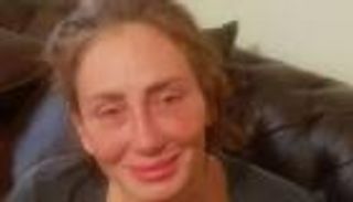 قبل ريهام سعيد.. فنانات سقطن في «فخ عمليات التجميل» (صور)