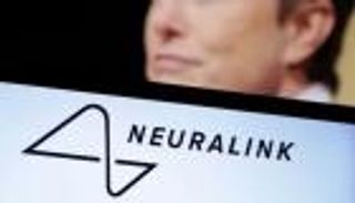 تيليباثي.. إيلون ماسك يعلن نجاح زرع شريحة دماغية في أول إنسان