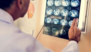 العلاج يعمل على إصلاح باب يتحكم في تدفق البوتاسيوم بالدماغ