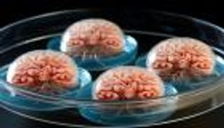 تصميم «أدمغة صغيرة».. اختراق يساعد في تصميم أدوية الخرف