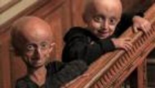 علاج الشيخوخة المبكرة.. اكتشاف بروتين يمهد لاختراق دوائي كبير