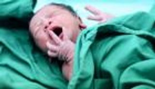 أثارت جدلا في تونس.. طبيبة تبث عملية ولادة مباشرة على تيك توك