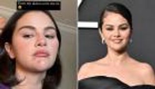 سيلينا جوميز تكشف عن عيوب بشرتها.. جمال طبيعي