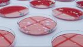 تقرير دولي: وفاة عشرات الملايين بسبب البكتيريا بحلول 2050