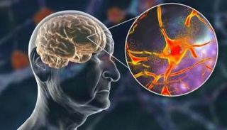 تحديد 13 بروتينا له علاقة بشيخوخة الدماغ