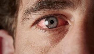 تلوث في قطرة العين